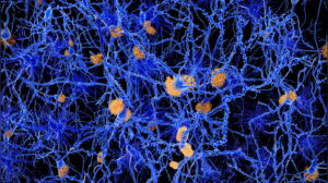 Stress Impact: Four Ways Stress Can Compromise Your Lymphatic System