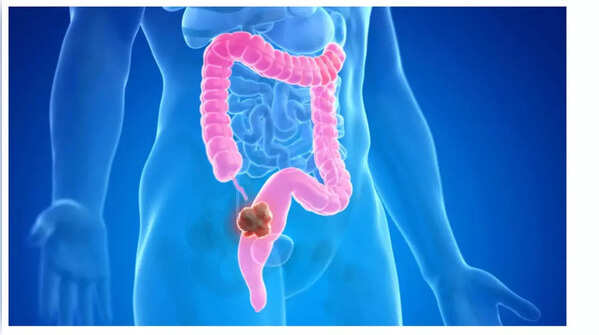 Illustration of rapid weight loss, a warning sign of potential health issues