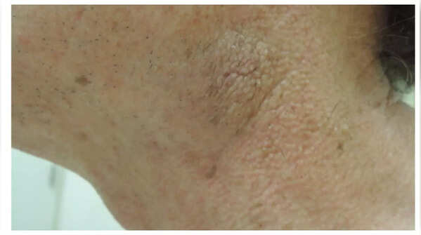 Person experiencing itchy skin.