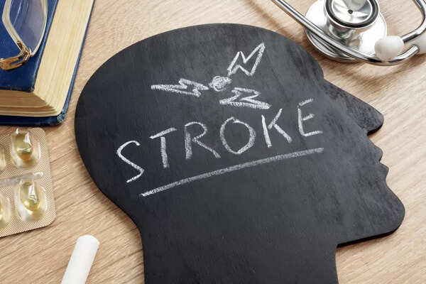 Doctor examining brain scan after stroke