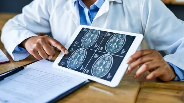 Human brain illustration