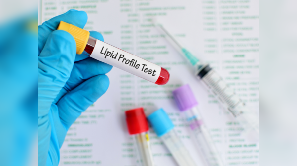 Regular monitoring of lipid markers for heart health
